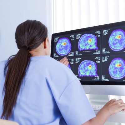 pet scan step 6